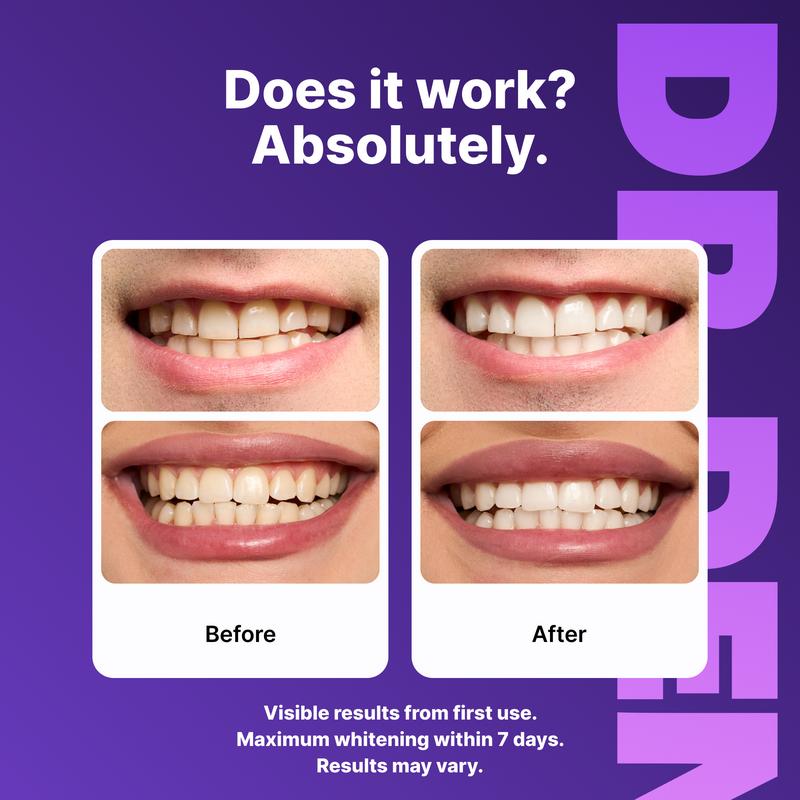 Purity® Purple Teeth Whitening Strips