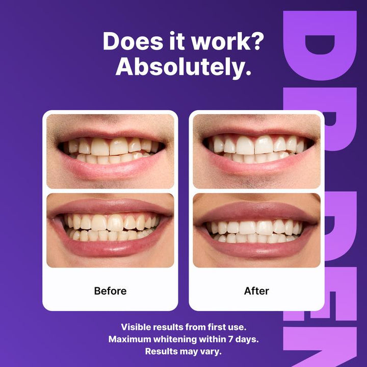Purity® Purple Teeth Whitening Strips